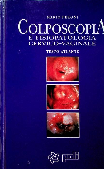 Colposcopia e fisiopatologia cervico-vaginale: testo atlante - Mario  Speroni - Libro Usato - Poli 