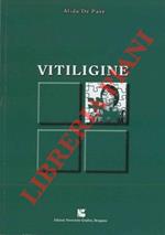 Vitiligine