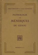 Pathologie des menisques du genou