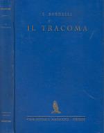 Il tracoma