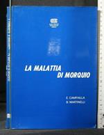 La Malattia di Morquio