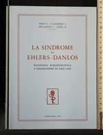 La Sindrome di Ehlers-Danlos