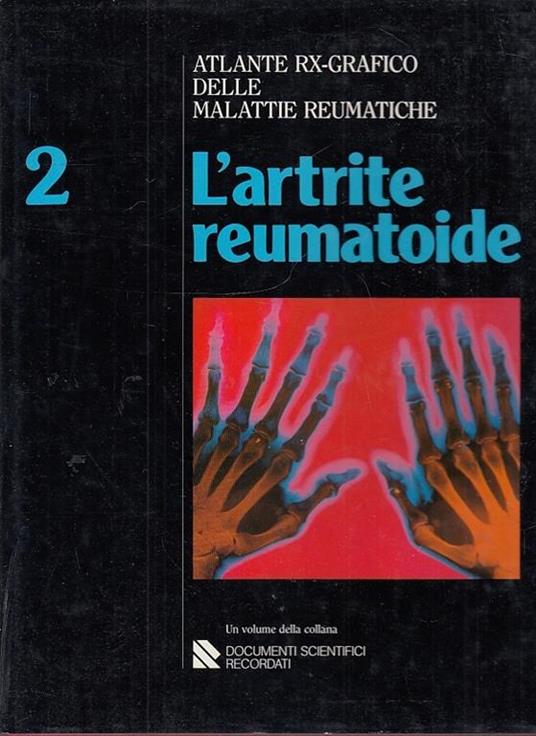 L artrite Reumatoide 2 Ignazio Caruso Libro Usato Documenti