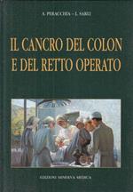 Cancro Colon E Retto Operato