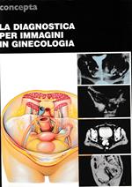 La diagnostica per immagini in ginecologia