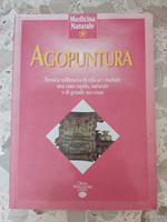 Agopuntuta