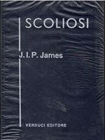 Scoliosi