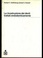 La ricostruzione dei denti trattati endodonticamente