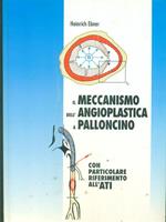 Il meccanismo dell'angioplastica a palloncino. Con particolare riferimento all'ATI