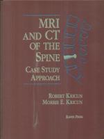 MRI and CT of the Spine