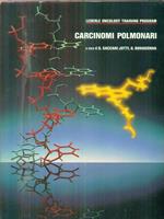 Carcinomi polmonari