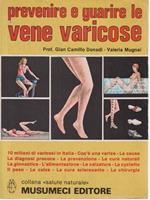   Prevenire e guarire le vene varicose