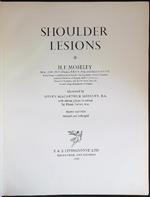 Shoulder Lesions