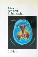 Ictus cerebrale in immagini. In 6 fasi