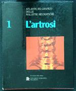 L' artrosi