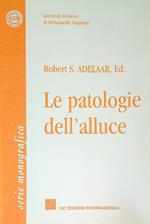 Le patologie dell'alluce