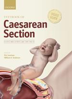 Textbook of Caesarean Section