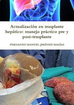 Actualizacion en trasplante hepatico: manejo practico pre y post-trasplante