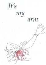 It's my arm