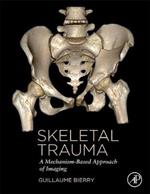 Skeletal Trauma: A Mechanism-Based Approach of Imaging