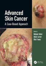 Advanced Skin Cancer: A Case-Based Approach