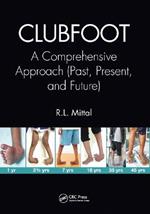 Clubfoot: A Comprehensive Approach (Past, Present, and Future)