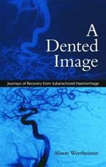 A Dented Image: Journeys of Recovery from Subarachnoid Haemorrhage