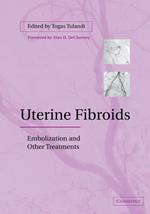 Uterine Fibroids: Embolization and other Treatments