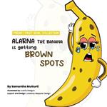 Alarna the banana is getting brown spots