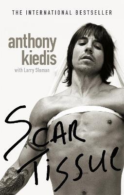 Scar Tissue - Anthony Kiedis - cover