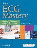 ECG Mastery: Improving Your ECG Interpretation Skills