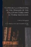 Clinical Illustrations of the Diseases of the Fallopian Tubes and of Tubal Gestation: a Series of Drawings With Descriptive Text and Histories of the Cases