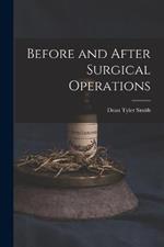 Before and After Surgical Operations