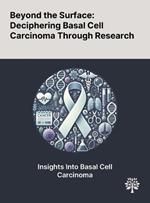 Beyond the Surface: Deciphering Basal Cell Carcinoma Through Research