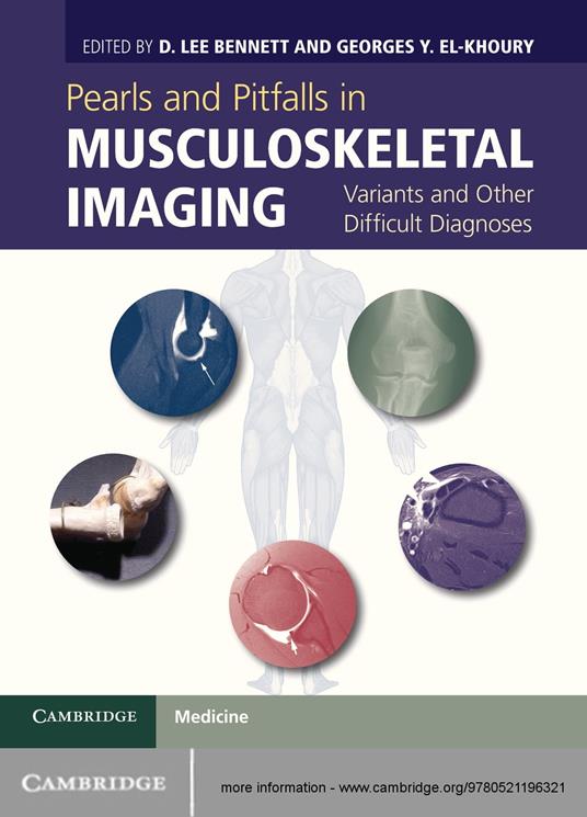 Pearls and Pitfalls in Musculoskeletal Imaging