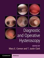 Diagnostic and Operative Hysteroscopy