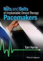 The Nuts and Bolts of Implantable Device Therapy: Pacemakers