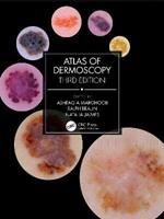 Atlas of Dermoscopy: Third Edition