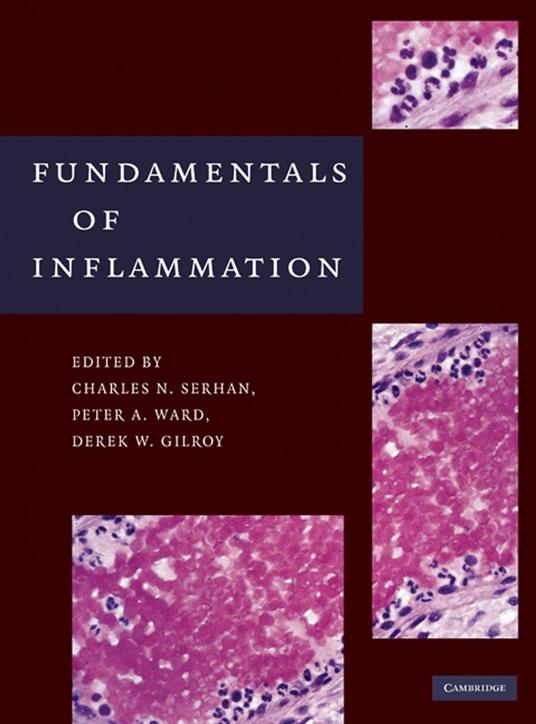 Fundamentals of Inflammation