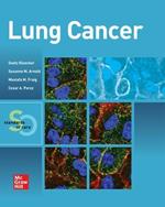 Lung Cancer:  Standards of Care