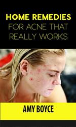 Home Remedies for Acne That Really Works