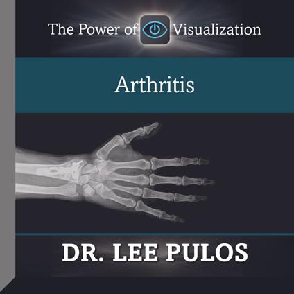 Arthritis