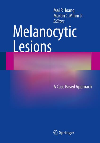 Melanocytic Lesions