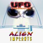 UFO Chronicles: Alien Implants