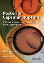 Posterior Capsular Rupture: A Practical Guide to Prevention and Management