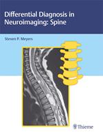 Differential Diagnosis in Neuroimaging: Spine