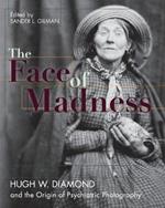 Face of Madness: Hugh W. Diamond and the Origin of Psychiatric Photography