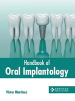 Handbook of Oral Implantology