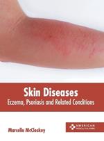 Skin Diseases: Eczema, Psoriasis and Related Conditions