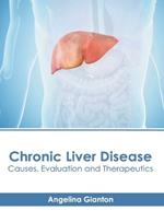 Chronic Liver Disease: Causes, Evaluation and Therapeutics